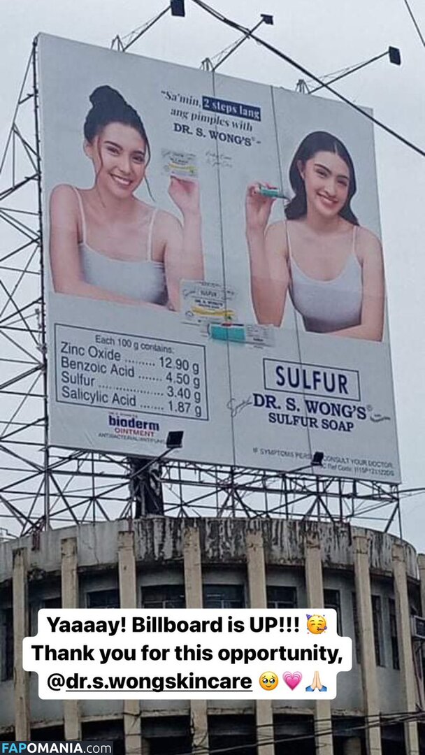 Analyn Barro Nu OnlyFans  Foto vazada #10